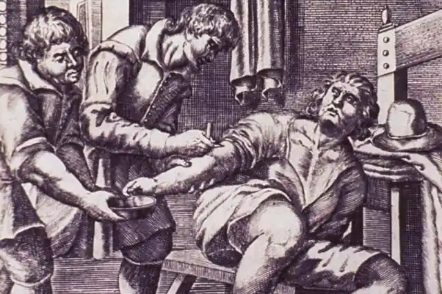 Bloodletting Was Thought To Cure Anything