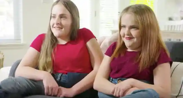 Conjoined Sisters Notoriously Separated - See Them Now 