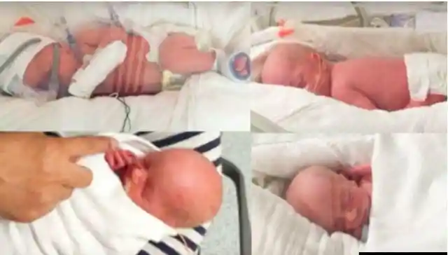 She Gave Birth To Quadruplets, Then Doctors Saw Her Babies’ Faces