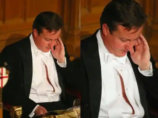 David Cameron Missed a Button… Or Five
