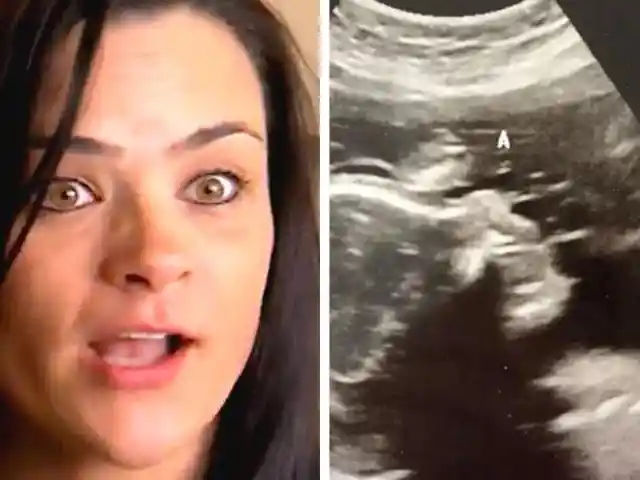 Surrogate Mother Is In Tears After Seeing Her Ultrasound