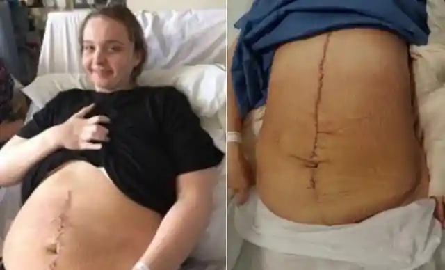 Woman With Giant Belly Shocked When Doctor’s Realize What’s Growing Inside Of Her!