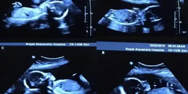 Doctor Tells Mom She’s Having Multiple Babies Before Revealing an Even Bigger Surprise