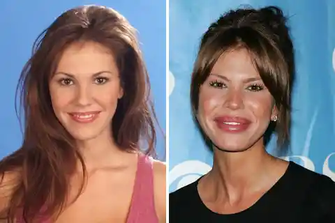 Top 20 Of The Worst Celebrity Plastic Surgeries. They Will Shock You! 