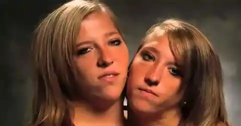 15 Interesting Facts About Famous Conjoined Twins Abby And Brittany Hensel