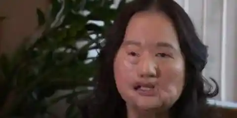 Woman Who Wore A Mask For 12 Years To Hide Husband's Secret Finally Speaks Out