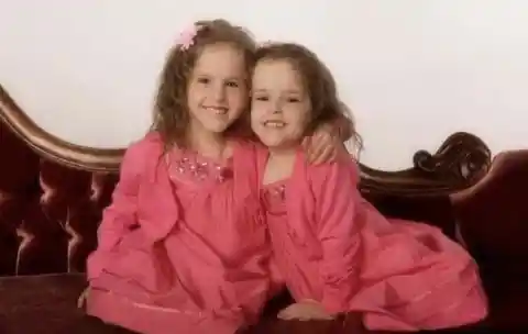 Conjoined Sisters Notoriously Separated - See Them Now 