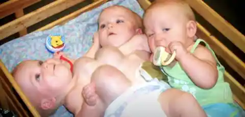 Mom Famously Gave Up Rare Triplets With 2 Conjoined At Pelvis. 17 Years Later, Their Life Is Different