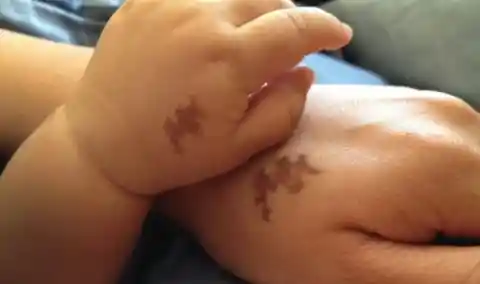 Birthmark Tattoo