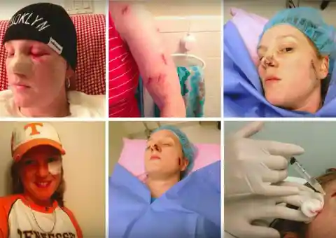 Tanning Addicted Teen Shows The Dangers Of Tanning After Having 86 Surgeries In Her 40s