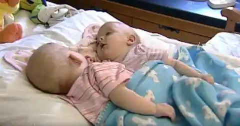 Conjoined Twins Finally Bare All To Show Us How They Really Look Like Below...