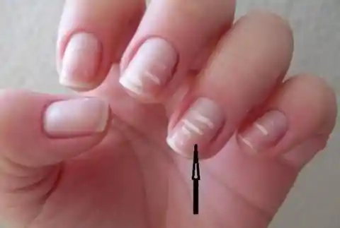 19. Changes In Nails